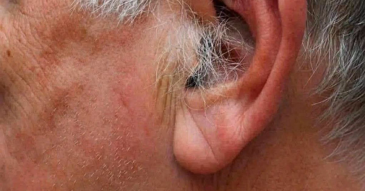 اذا ظهر الشعر على اذنيك او بداخله فهذا انذار من جسمك على اصابتك بـ