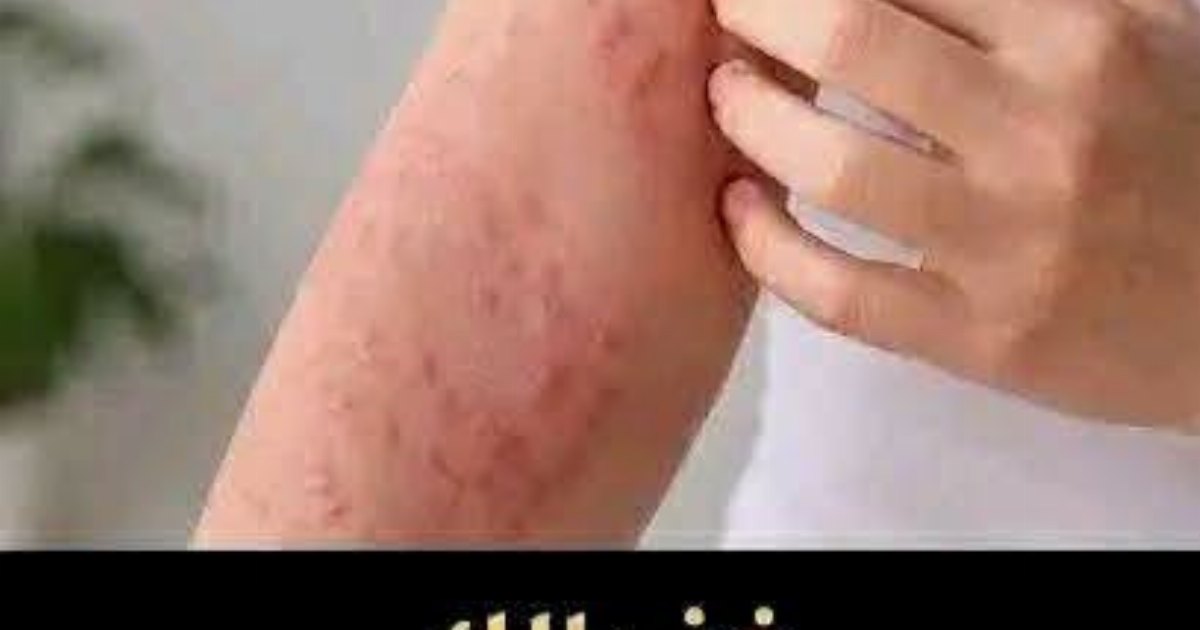 انتبه عـ.ـلامات تحـ.ـذيرية على الجسـ.ـم لا تتجاهلها