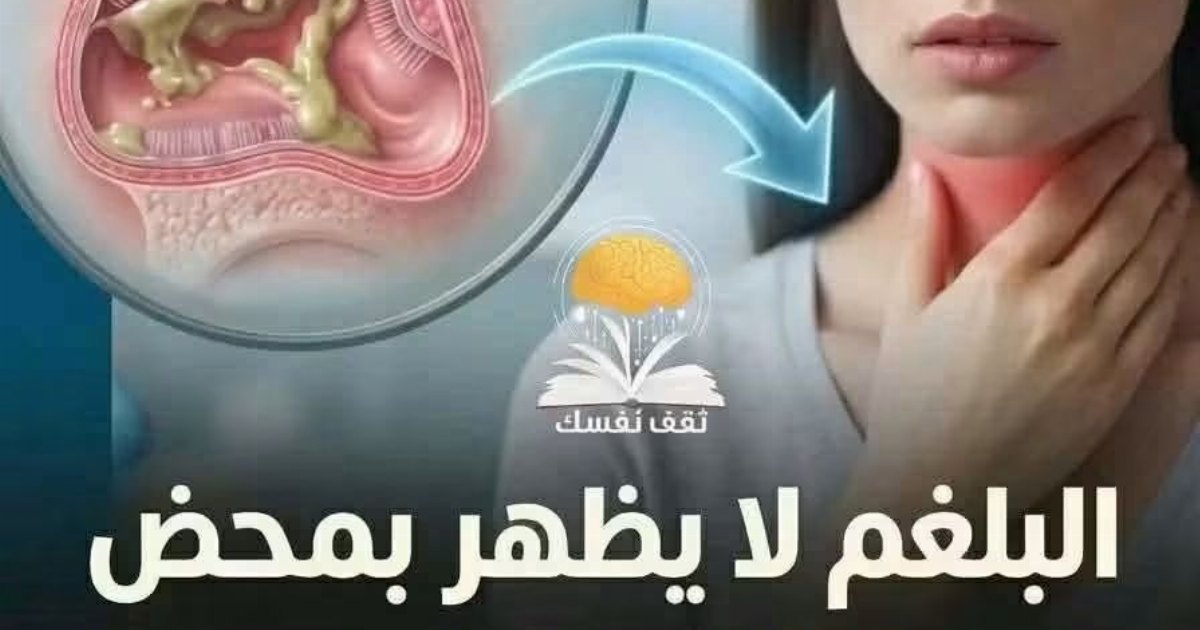 انـ.ـتبه من نـ.ـوبـ.ـات البلغم ، يمكن ان يكون إنـ.ـذار لمشكلة صحية! اكتشف  السبب وكيف تتخلـ.ـص منه بوصـ.ـفات طبيعية اكـ.ـتب تـ.ـم وشـ.ـاهد التفـ.ـاصيل في التعلـ