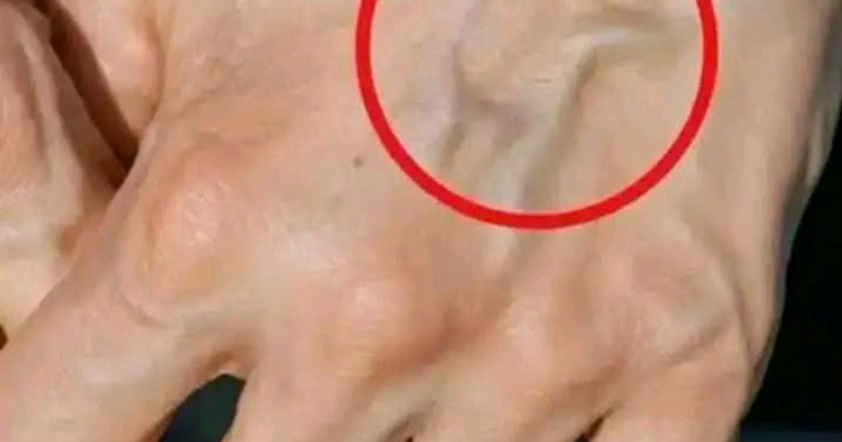 إذا كانت عـ.ـروقك بارزة سواء كنت صغير او كبير في السن ، فهذا يعني أنك..