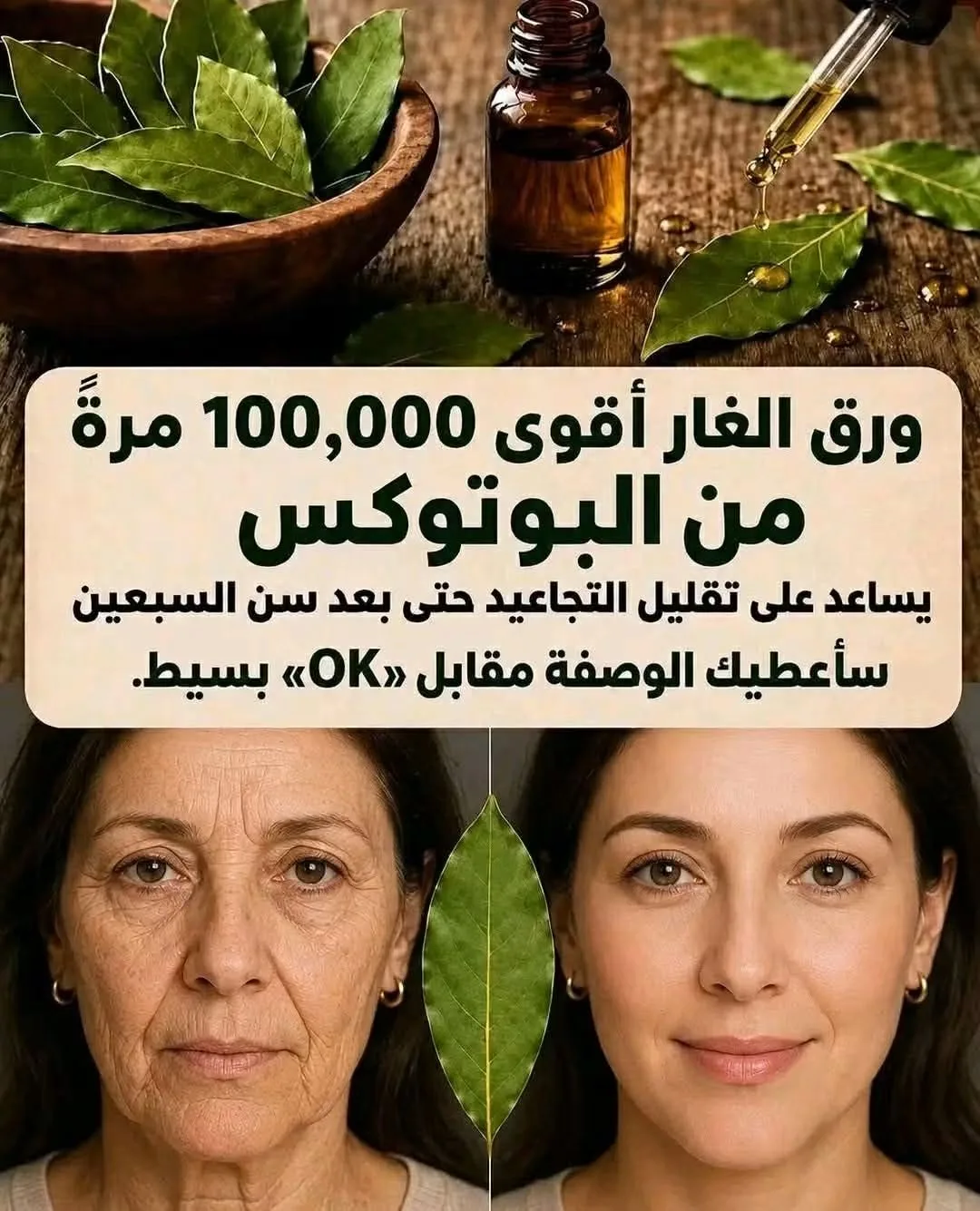 أوراق الغار أقوى بـ 100,000 مرة من البوتوكس. فهي تزيل التجاعيد حتى في