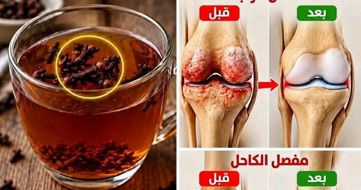 فـ.ـوائد القرنفل واستخدامات مشروب القرنفل لتقـ.ـوية العظام وتسكـ.ـين الم المفـ.ـاصل وطـ.ـريقة التحضير سأعطـ.ـيك التفـ.ـاصيل مقـ.ـابل كلـ.ـمة “OK” بسيـ.ـطة في ال