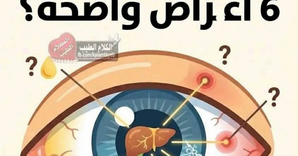 الكبد المـ.ـريض يرسل رسائله عبر العين 6 أعـ.ـراض واضحة