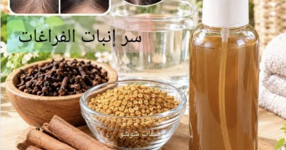#بخاخ القرفة والقرنفل والحلبة للشعر.. فوائده ومحاذيره للمزيد....